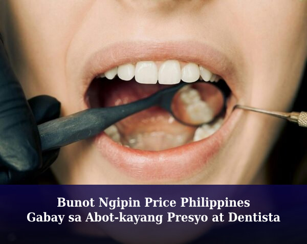 Bunot Ngipin Price Philippines