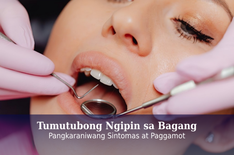 Tumutubong Ngipin sa Bagang